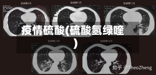 疫情硫酸(硫酸氢绿喹)