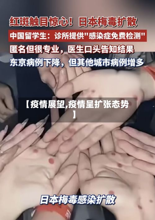 【疫情展望,疫情呈扩张态势】-第2张图片
