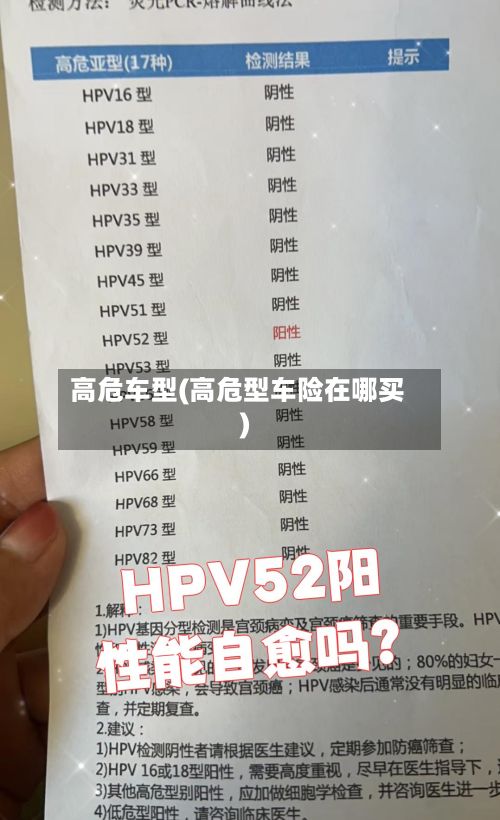 高危车型(高危型车险在哪买)