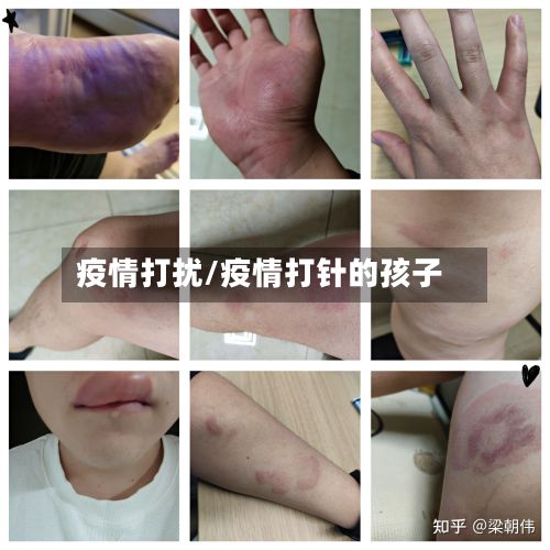 疫情打扰/疫情打针的孩子