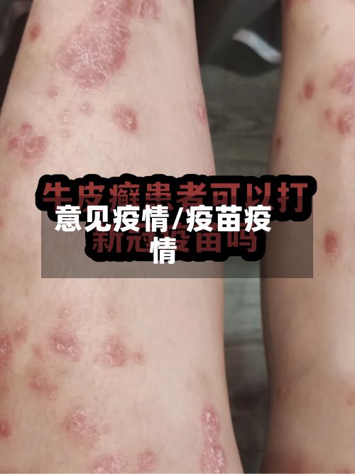 意见疫情/疫苗疫情-第3张图片